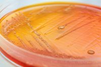 RECUENTO MICROBIOLOGICO LABORATORIOS LBC