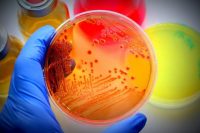 Muestreo microbiologico del aire LBC