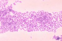 Bacteria Micrococcus laboratorios LBC