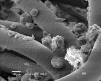 LBC mecanismos de filtracion